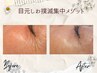 【目元のシワ徹底ケア！】集中メゾット　顔全体も施術　体験クーポン