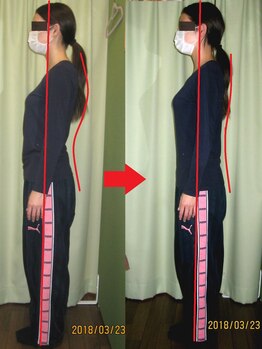 チャラク(charaku)/【20代N様：反り腰・結婚式前】