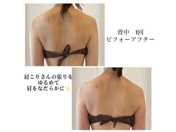 エミア(Emia)/ガチガチ肩凝りにオススメ◎