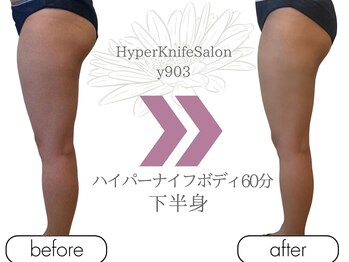 ワイキューマルサン(y903)/ハイパーナイフボディ60分下半身