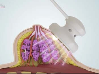 サラエクセレント 新宿(SARA EXCELLENT)/《バストアップ》