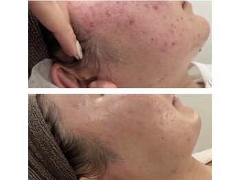 モアトゥインクル 岡山店(MORE twinkle)