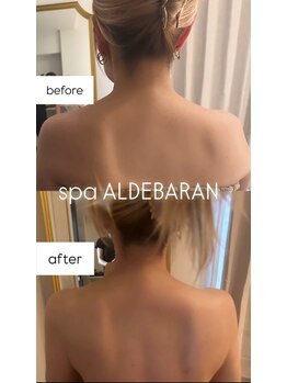 スパアルデバラン(spa.ALDEBARAN)/【深層リンパ120分】