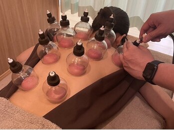 樹鍼灸整骨院/吸玉・カッピング