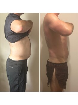 ベラ/3週間「腸もみ」だけでこの結果!