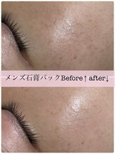 アスピリア(aspirer a')/石膏パックでお顔のデトックス◎