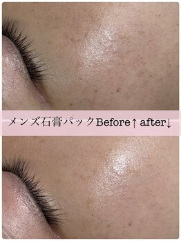 アスピリア(aspirer a')/石膏パックでお顔のデトックス◎