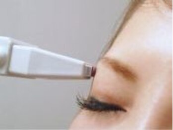 エンジェリック カラーズ(Angelic colors)/眉周り脱毛　(1回)