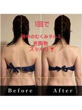 ミオ(mio)/ビフォーアフター