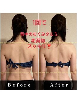 ミオ(mio)/ビフォーアフター