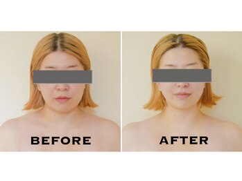 リレ(LILLET)/小顔コルギのビフォーアフター