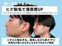 アロマ(AROMA)