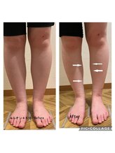 ヨサパーク アミカル 八幡山店(YOSAPARK amical)/ルルオンで脚のむくみ改善！