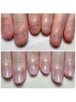 スマイルニコ(smile nico)/