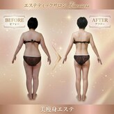 ラエッセス(A Laessess)