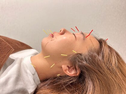 たかさきひかり鍼灸整骨院の写真