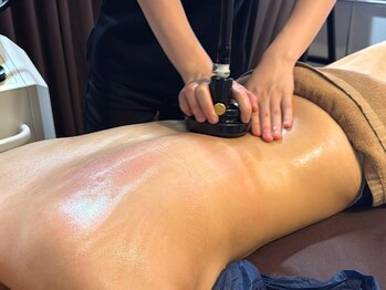 ビーフィール 千葉店(be feel)/背中のセル脂肪を吸い上げ