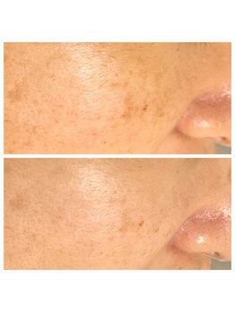 エリン(ERIN)/セラピール