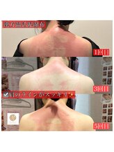 フェアリー 小松店/NEW!漢方温活泥湿布でデトックス