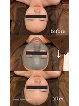 エングロー(Englow)/絶対美白！話題の復元パック