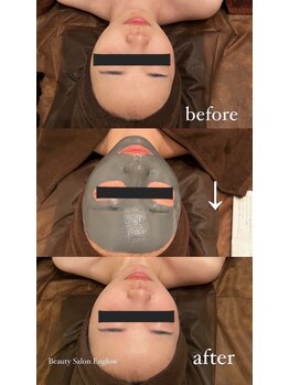 エングロー(Englow)/絶対美白！話題の復元パック