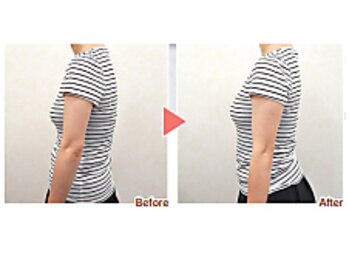 くすの木 治療院/肩甲骨のくびれ