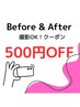 施術時に　Before & After のお写真ＯＫ　の方　500円ＯＦＦ