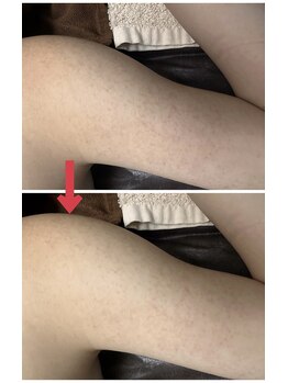 スリリアン 銀座/★お客さまビフォーアフター★