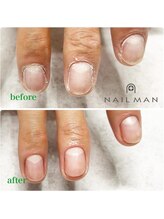 ネイルマン 横浜店(Nail Man)/ハンドケアのビフォー＆アフター