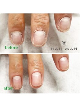 ネイルマン 横浜店(Nail Man)/ハンドケアのビフォー＆アフター