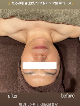 ピエルポゼ(Piereposer)/頬のもたつきすっきり!