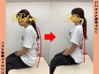 にこちゃん整体院サロン/【ストレートネックで首が太く】
