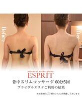 エスプリ 銀座店/ブライダルエステ痩身