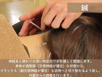 みずえ駅ビル整骨院/鍼灸施術　瑞江/鍼灸/美容鍼