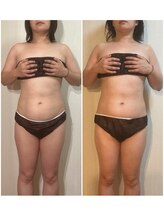 ブルームオーラ 月(BLOOM AURA)/キャビゼロ　４種機能の脅威！