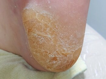 練馬フットケアセンター/◆ドイツ式トータルフットケア☆