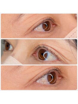 ヴァーチュープラス(VIRTUE PLUS)/