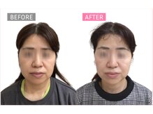 ジタ整体院/小顔コース☆50代女性