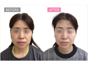 ジタ整体院/小顔コース☆50代女性