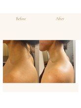 エードット 銀座(A.)/before　→　after