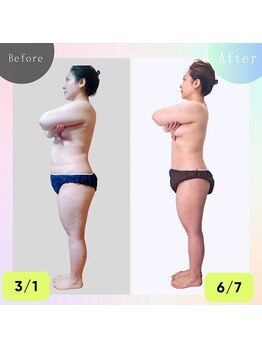 ナチュラルボディラボ 草津店/3ヶ月12回！