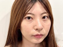 トミー(Tommy)/まつげパーマ