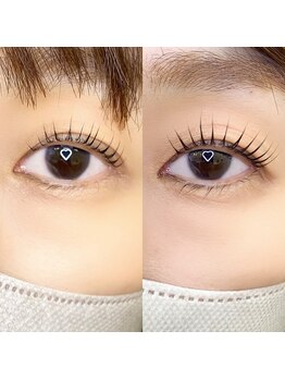 ビームズ トータルビューティー 西中島店(BeeMs Total Beauty)/ラッシュアディクトの効果