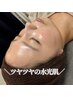《リピーター様》ヘッドスパ付きハーブピーリング　６０分　