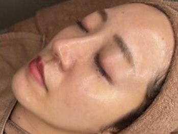 ベル(Belle)の写真/≪駆け込みピーリング☆≫地域稀少！育てるピーリング【ララピール】で、肌育を楽しむ！理想のツヤ肌に♪