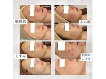 ミベル(MeBell)の雰囲気（【肌質改善】症例多数/肌質ごとに適切なメニューをご提案◎）
