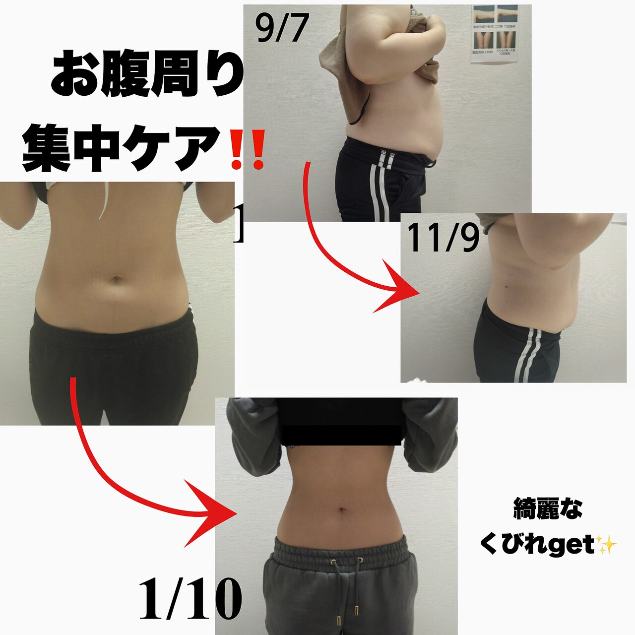 【本気で痩せたい方は必見!】最強痩身☆脂肪冷却1箇所+キャビ+脂肪分解剤