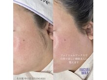 スタジオ キー(STUDIO KEY)の雰囲気（フェイシャルワックスで見せたくなるお肌になりませんか(^^)）