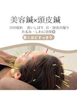 ブロッサム(Blossom)の写真/[睡眠の質改善特化◇美容鍼×頭皮鍼]がオススメ☆美容鍼&頭の鍼で小顔&美肌効果だけでなく頭痛/眼精疲労に!