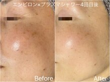 クレール(CLAIR)の雰囲気(年齢によるシワ、くすみ、毛穴の開きはお任せください!)